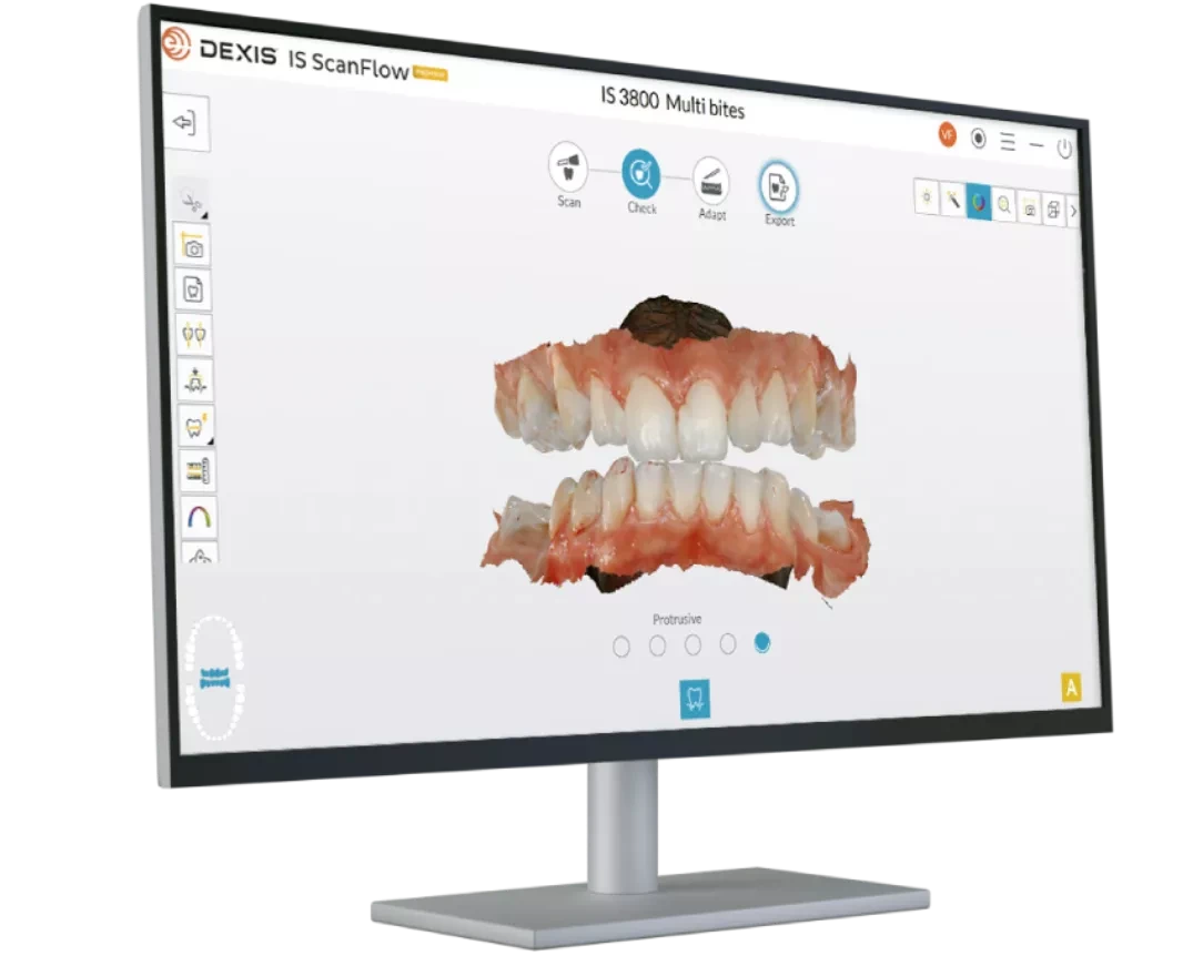 Зачем покупать интраоральный сканер в 2026 году